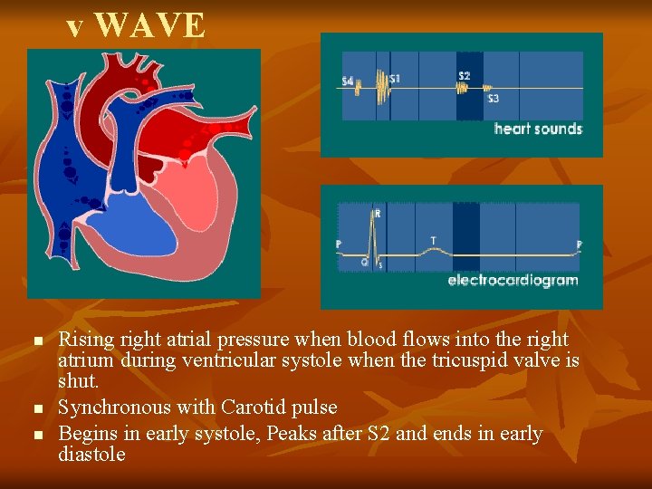 v WAVE n n n Rising right atrial pressure when blood flows into the