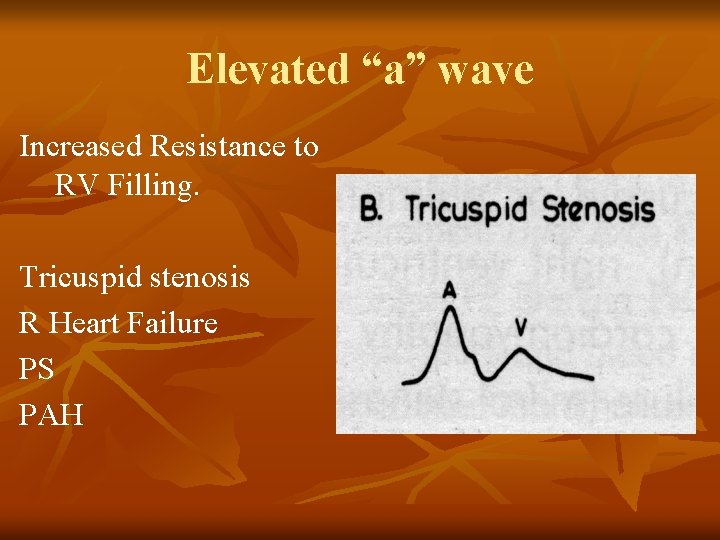 Elevated “a” wave Increased Resistance to RV Filling. Tricuspid stenosis R Heart Failure PS