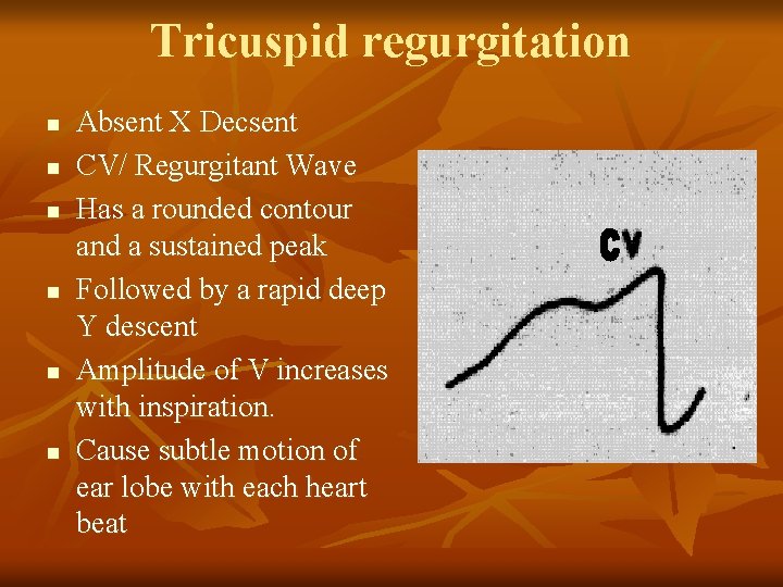 Tricuspid regurgitation n n n Absent X Decsent CV/ Regurgitant Wave Has a rounded