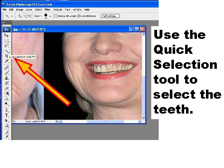 Use the Quick Selection tool to select the teeth. 