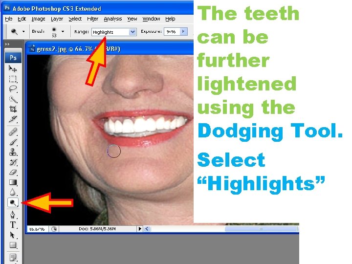 The teeth can be further lightened using the Dodging Tool. Select “Highlights” 