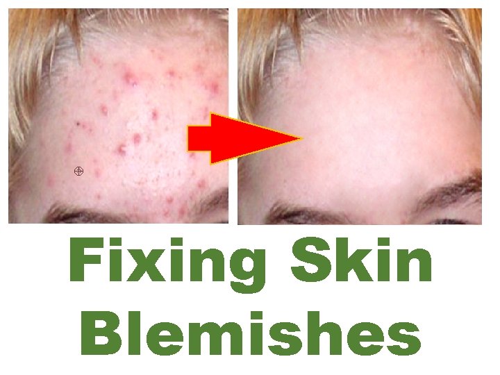 Fixing Skin Blemishes 