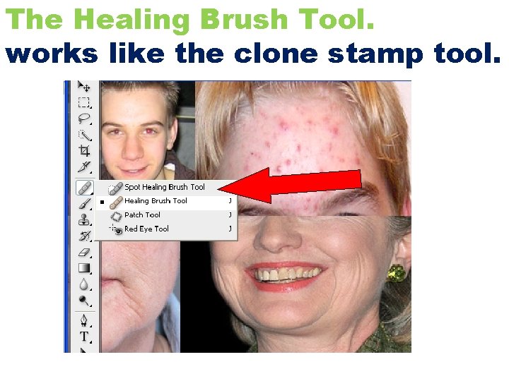 The Healing Brush Tool. works like the clone stamp tool. 