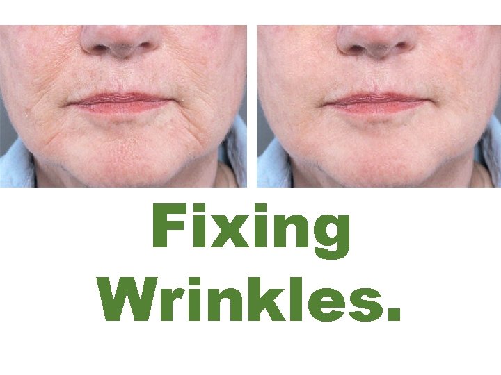 Fixing Wrinkles. 