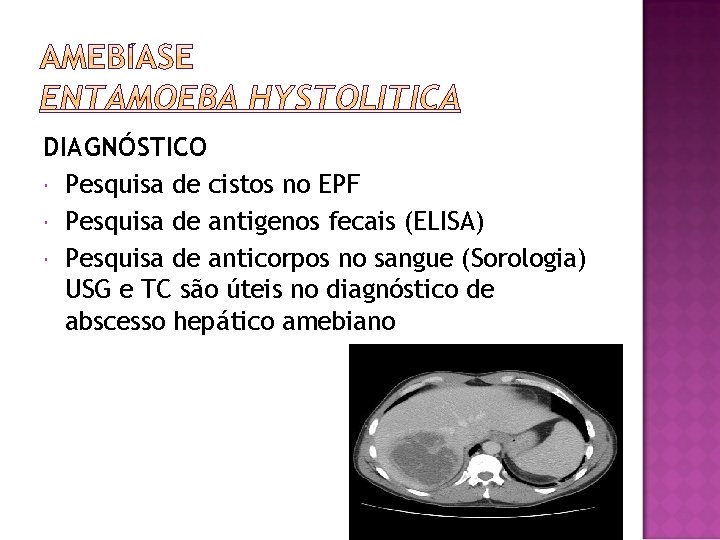 DIAGNÓSTICO Pesquisa de cistos no EPF Pesquisa de antigenos fecais (ELISA) Pesquisa de anticorpos