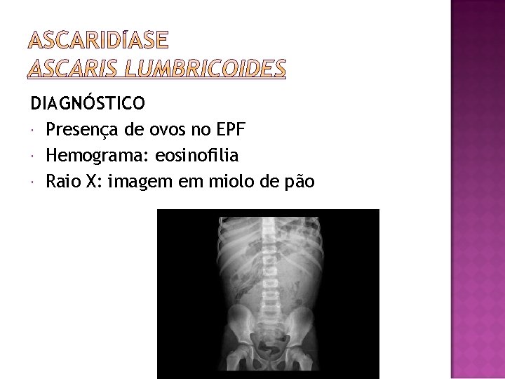 DIAGNÓSTICO Presença de ovos no EPF Hemograma: eosinofilia Raio X: imagem em miolo de