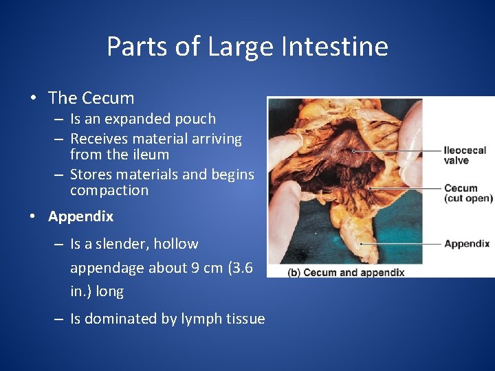 Parts of Large Intestine • The Cecum – Is an expanded pouch – Receives