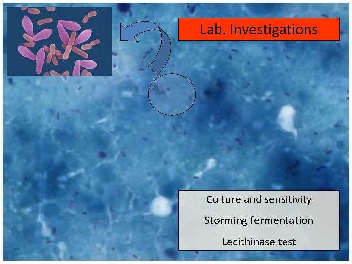 Lab. Investigations Culture and sensitivity Storming fermentation Lecithinase test 