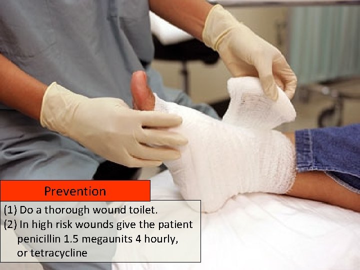 Prevention (1) Do a thorough wound toilet. (2) In high risk wounds give the