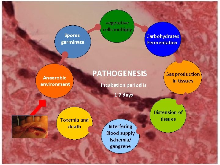 Spores germinate Anaerobic environment vegetative cells multiply Carbohydrates Fermentation PATHOGENESIS Incubation period is Gas