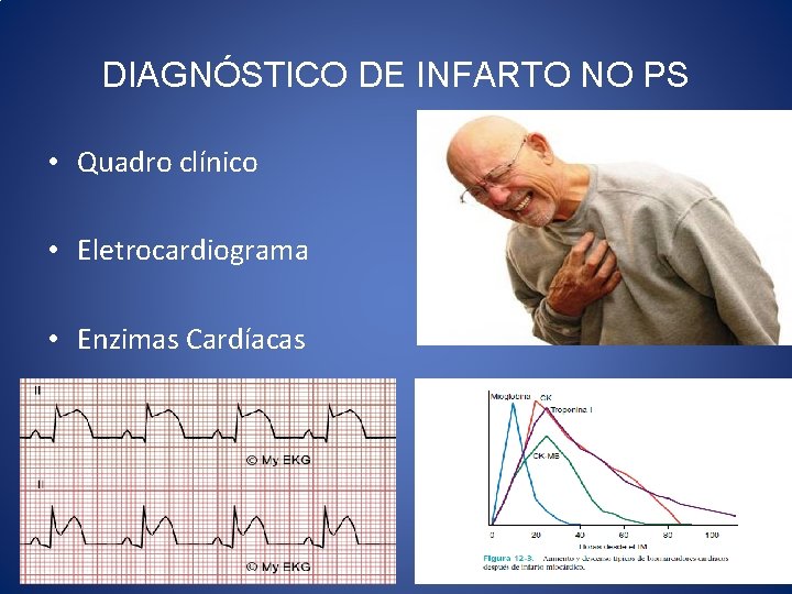 DIAGNÓSTICO DE INFARTO NO PS • Quadro clínico • Eletrocardiograma • Enzimas Cardíacas 