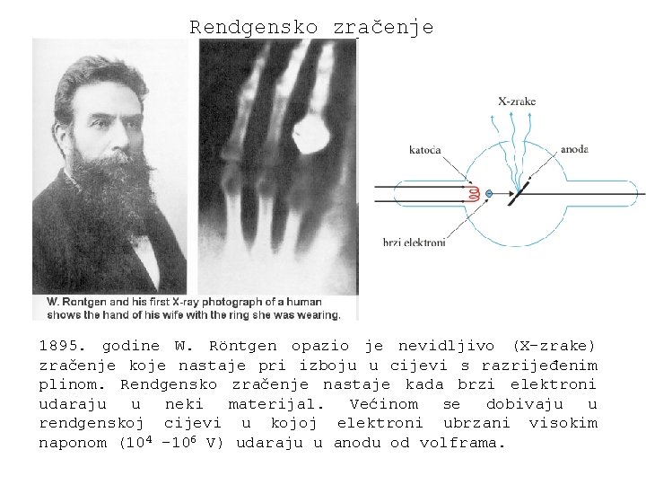 Rendgensko zračenje 1895. godine W. Röntgen opazio je nevidljivo (X-zrake) zračenje koje nastaje pri