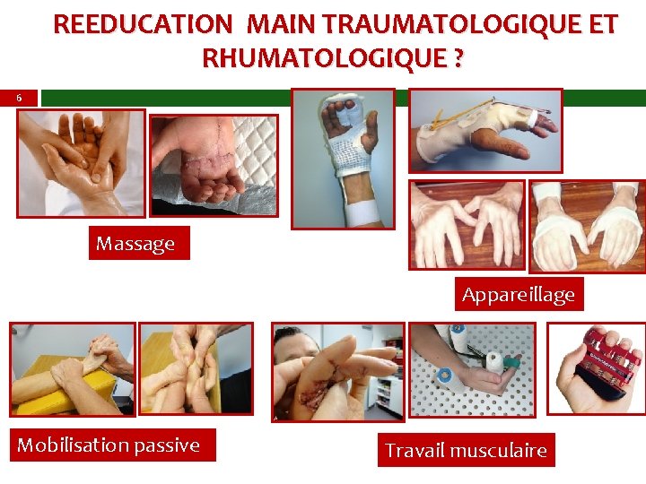  REEDUCATION MAIN TRAUMATOLOGIQUE ET RHUMATOLOGIQUE ? 6 Massage Appareillage Mobilisation passive Travail musculaire