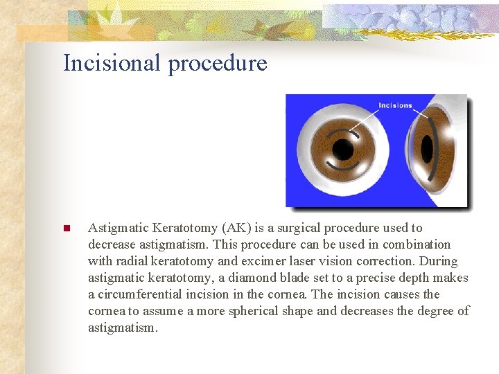 Incisional procedure n Astigmatic Keratotomy (AK) is a surgical procedure used to decrease astigmatism.