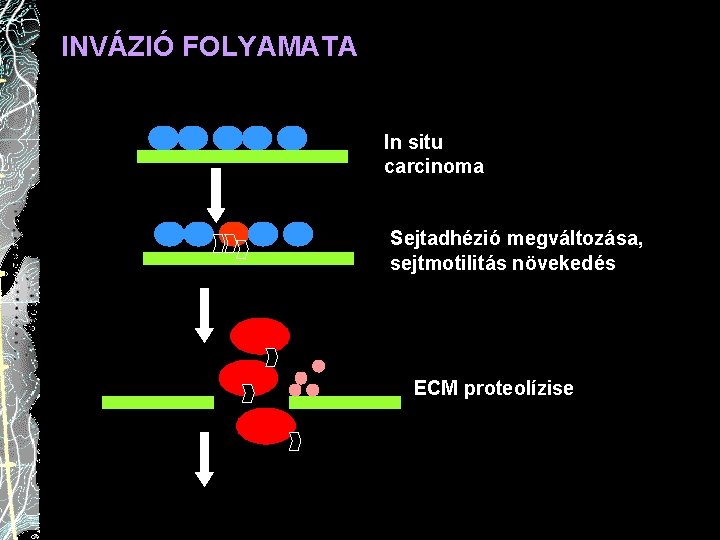 INVÁZIÓ FOLYAMATA In situ carcinoma Sejtadhézió megváltozása, sejtmotilitás növekedés ECM proteolízise 