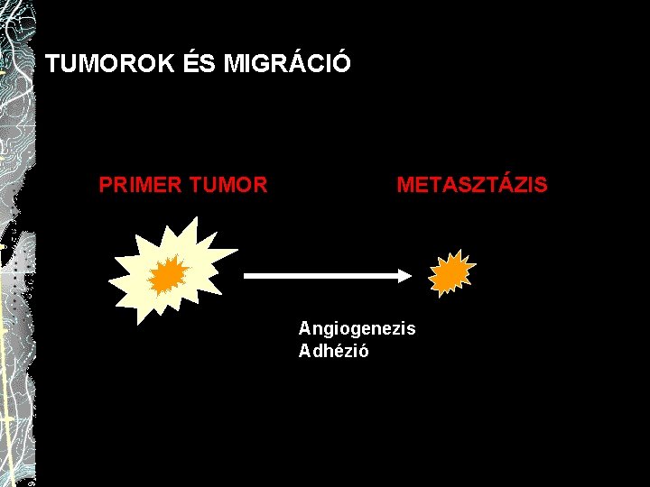 TUMOROK ÉS MIGRÁCIÓ PRIMER TUMOR METASZTÁZIS Angiogenezis Adhézió 