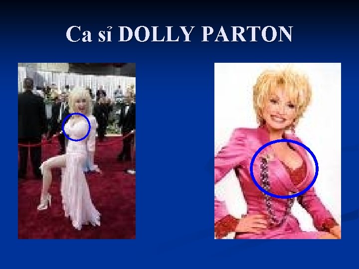 Ca sỉ DOLLY PARTON 