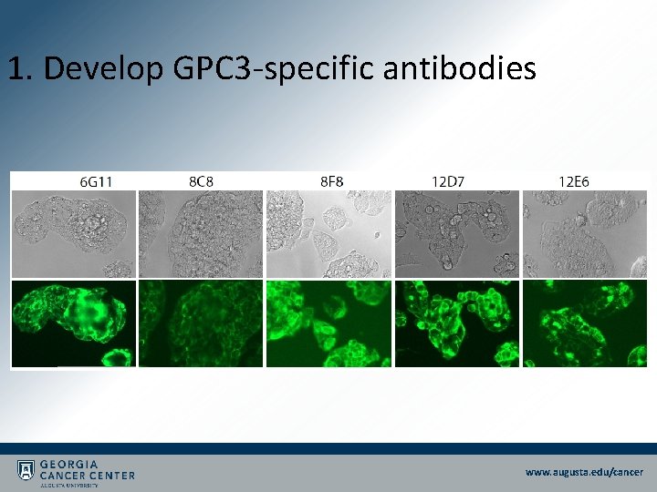 1. Develop GPC 3 -specific antibodies www. augusta. edu/cancer 1. Develop GPC 3 -specific antibodies www. augusta. edu/cancer
