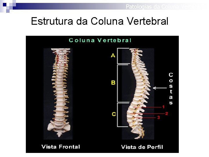 Patologias da Coluna Vertebral Estrutura da Coluna Vertebral 