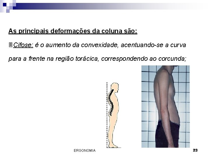 As principais deformações da coluna são: 3 Cifose: é o aumento da convexidade, acentuando-se