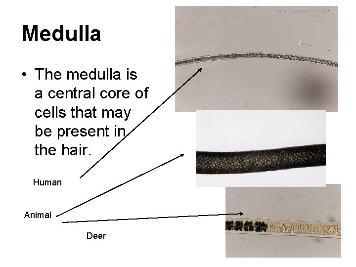 Medulla • The medulla is a central core of cells that may be present