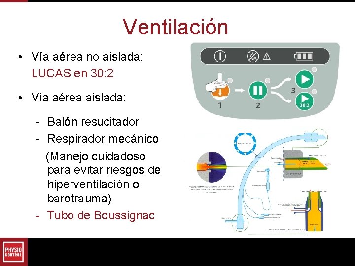 Ventilación • Vía aérea no aislada: LUCAS en 30: 2 • Via aérea aislada: Ventilación • Vía aérea no aislada: LUCAS en 30: 2 • Via aérea aislada: