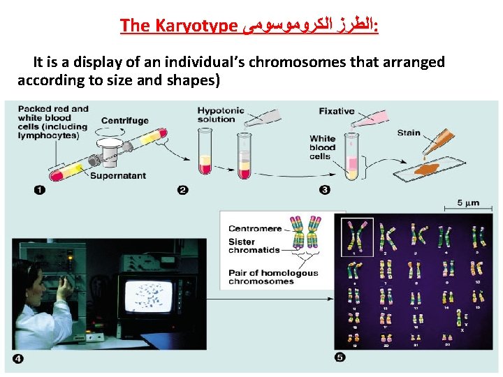 The Karyotype ﺍﻟﻄﺮﺯ ﺍﻟﻜﺮﻭﻣﻮﺳﻮﻣﻰ : It is a display of an individual’s chromosomes that