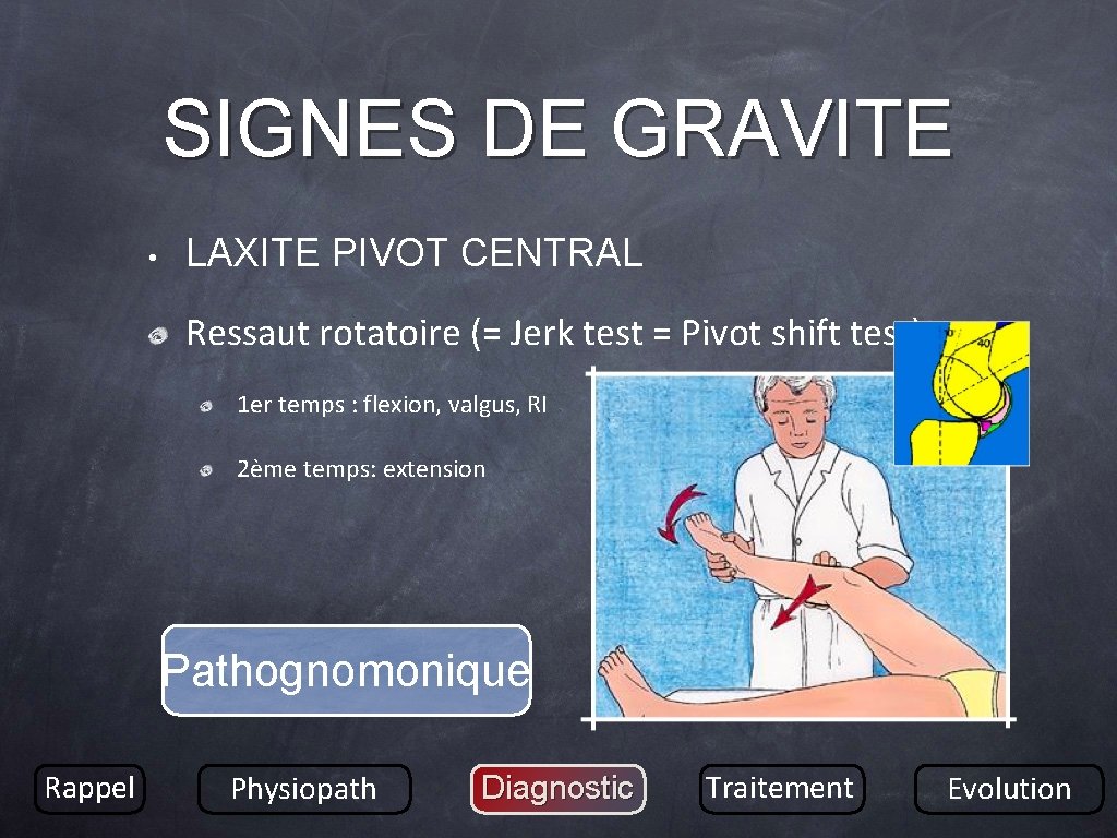 SIGNES DE GRAVITE • LAXITE PIVOT CENTRAL Ressaut rotatoire (= Jerk test = Pivot