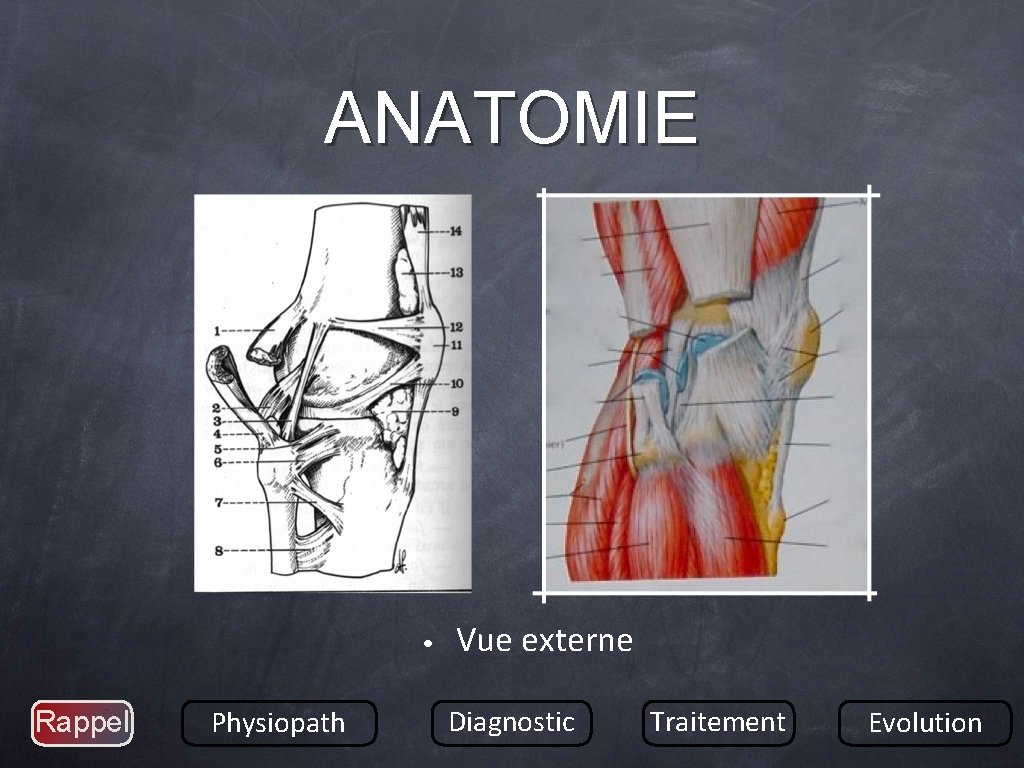 ANATOMIE • Rappel Physiopath Vue externe Diagnostic Traitement Evolution 