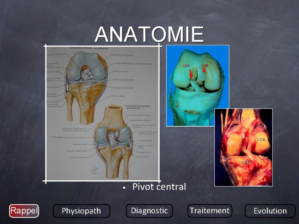 ANATOMIE • Rappel Physiopath Pivot central Diagnostic Traitement Evolution 
