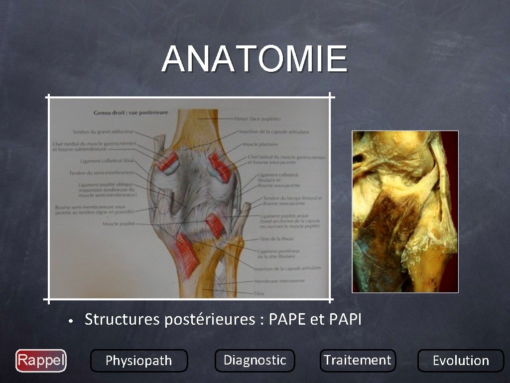 ANATOMIE • Rappel Structures postérieures : PAPE et PAPI Physiopath Diagnostic Traitement Evolution 