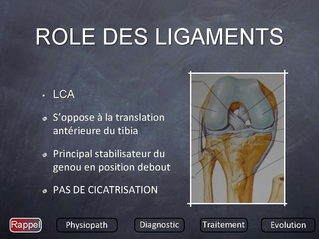 ROLE DES LIGAMENTS • LCA S’oppose à la translation antérieure du tibia Principal stabilisateur ROLE DES LIGAMENTS • LCA S’oppose à la translation antérieure du tibia Principal stabilisateur