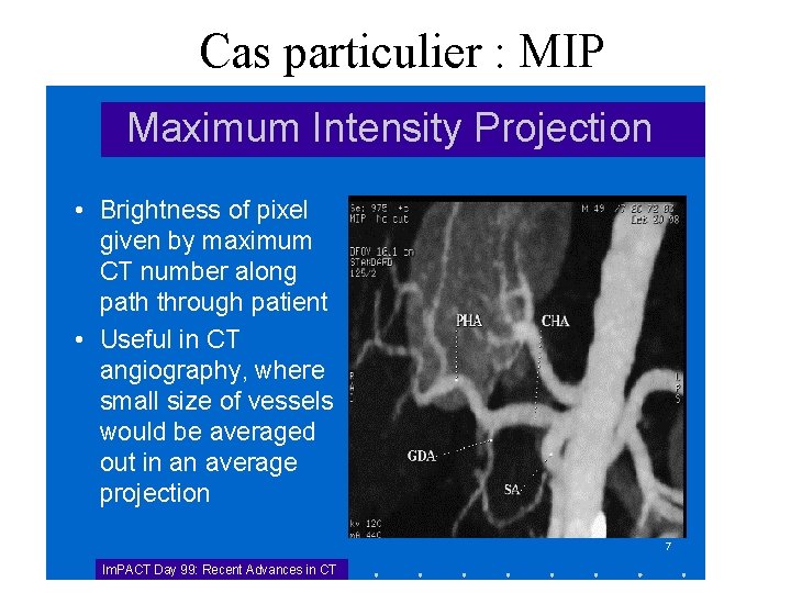 Cas particulier : MIP 