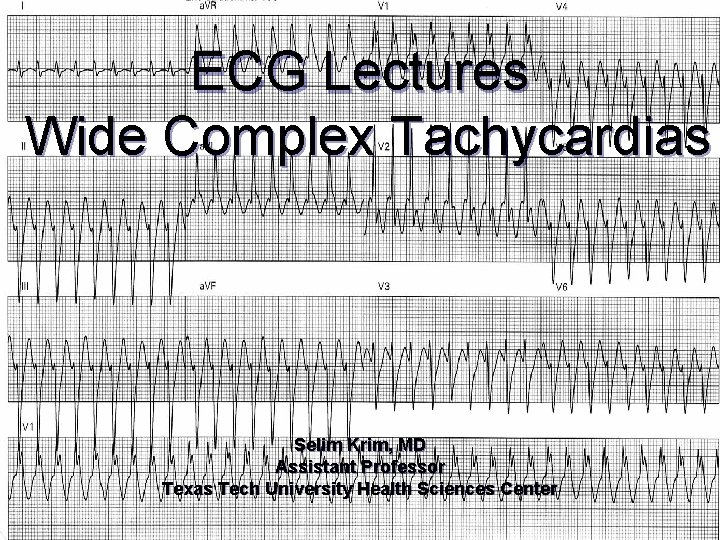  ECG Lectures Wide Complex Tachycardias Selim Krim, MD Assistant Professor Texas Tech University