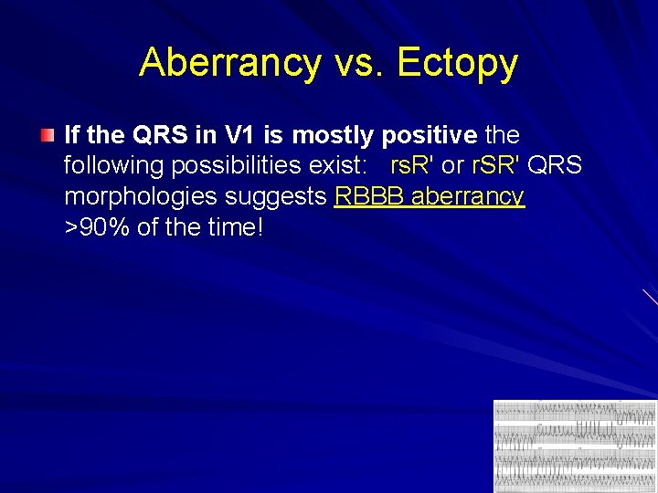 Aberrancy vs. Ectopy If the QRS in V 1 is mostly positive the following