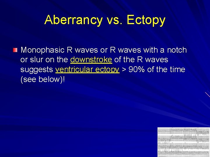 Aberrancy vs. Ectopy Monophasic R waves or R waves with a notch or slur