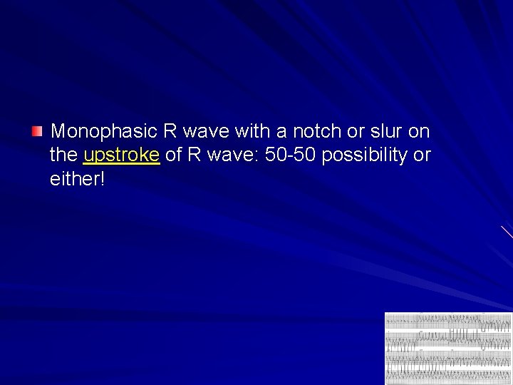 Monophasic R wave with a notch or slur on the upstroke of R wave: