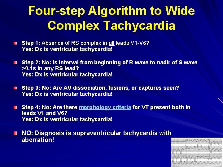 Four-step Algorithm to Wide Complex Tachycardia Step 1: Absence of RS complex in all