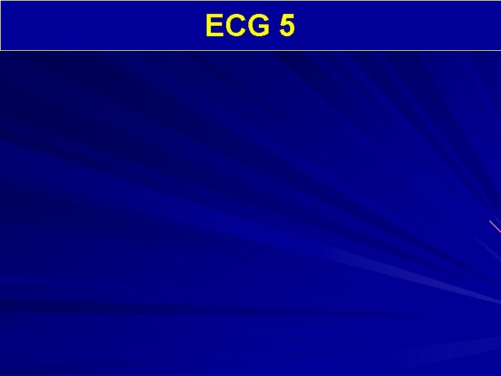 ECG 5 