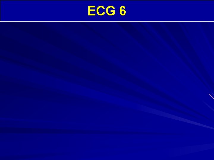 ECG 6 