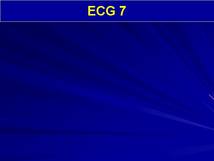 ECG 7 