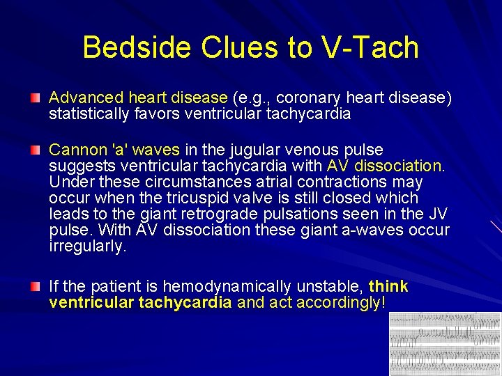 Bedside Clues to V-Tach Advanced heart disease (e. g. , coronary heart disease) statistically