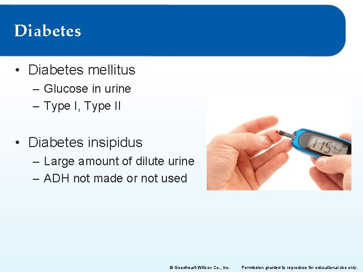 Diabetes • Diabetes mellitus – Glucose in urine – Type I, Type II •