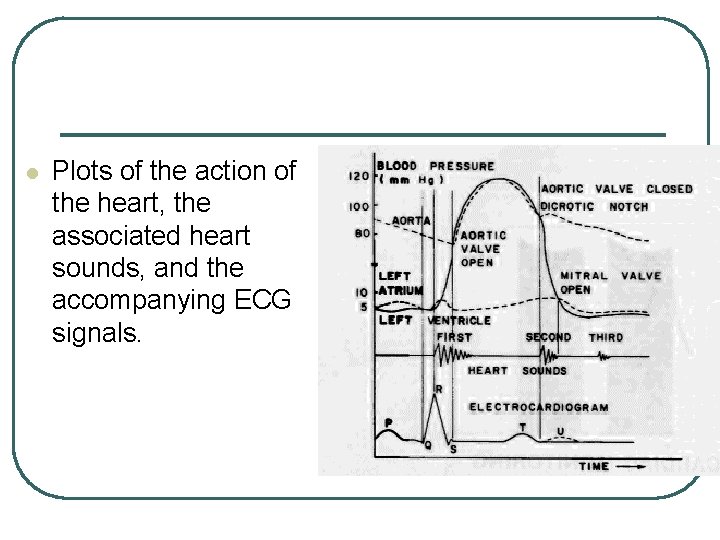 l Plots of the action of the heart, the associated heart sounds, and the l Plots of the action of the heart, the associated heart sounds, and the