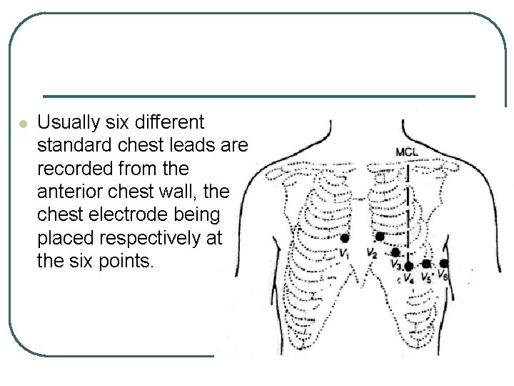 l Usually six different standard chest leads are recorded from the anterior chest wall, l Usually six different standard chest leads are recorded from the anterior chest wall,
