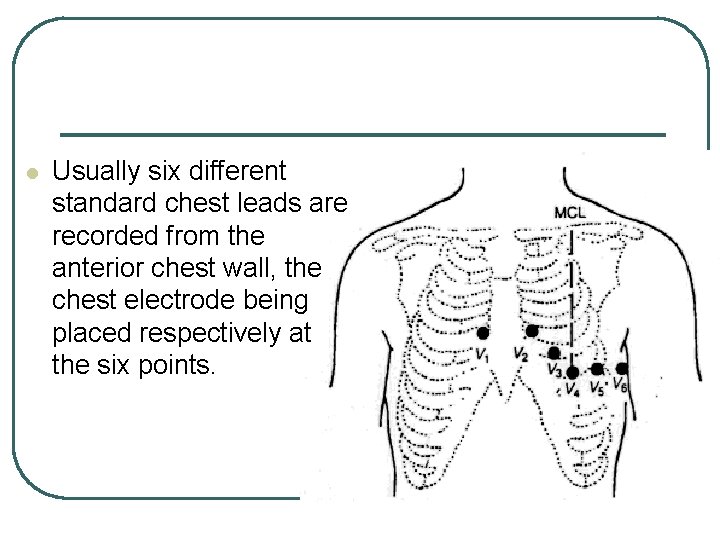 l Usually six different standard chest leads are recorded from the anterior chest wall,