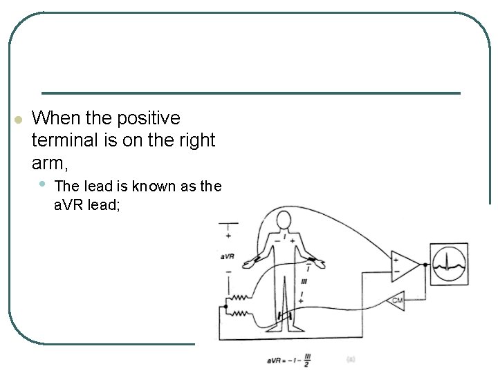 l When the positive terminal is on the right arm, • The lead is