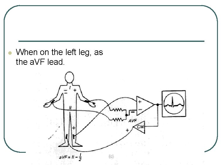 l When on the left leg, as the a. VF lead. l When on the left leg, as the a. VF lead.