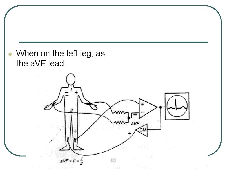 l When on the left leg, as the a. VF lead. 