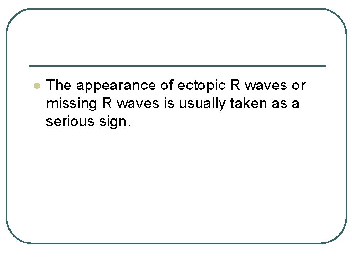 l The appearance of ectopic R waves or missing R waves is usually taken l The appearance of ectopic R waves or missing R waves is usually taken